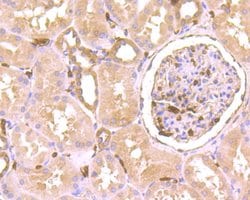 SEPT2 Recombinant Rabbit Monoclonal Antibody (JB41-30), Invitrogen 100