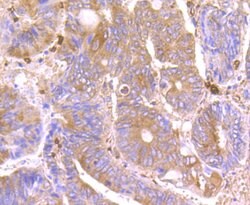 SEPT2 Recombinant Rabbit Monoclonal Antibody (JB41-30), Invitrogen 100