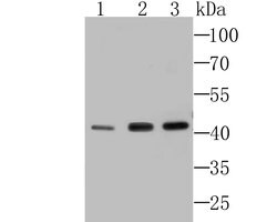 SEPT2 Recombinant Rabbit Monoclonal Antibody (JB41-30), Invitrogen 100