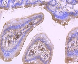 Invitrogen DDX6 Recombinant Rabbit Monoclonal Antibody (JB41-32) 100 &mu;L;