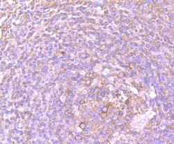 Invitrogen DDX6 Recombinant Rabbit Monoclonal Antibody (JB41-32) 100 &mu;L;