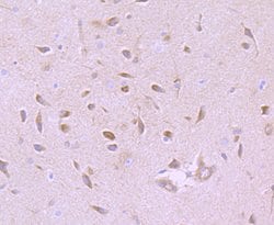 Invitrogen GABRA5 Recombinant Rabbit Monoclonal Antibody (JB34-19) 100 &mu;L | Buy Online | Invitrogen&trade; | Fisher Scientific