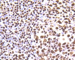 Invitrogen hnRNP U Recombinant Rabbit Monoclonal Antibody (JB23-43) 100 &mu;L | Buy Online | Invitrogen&trade; | Fisher Scientific