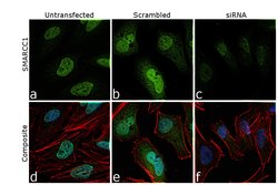 Invitrogen SMARCC1 Recombinant Rabbit Monoclonal Antibody (JB43-43) 100