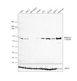 Invitrogen SMARCC1 Recombinant Rabbit Monoclonal Antibody (JB43-43) 100
