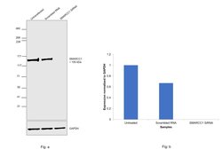 Invitrogen SMARCC1 Recombinant Rabbit Monoclonal Antibody (JB43-43) 100
