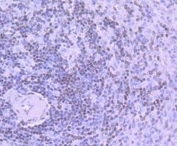 Invitrogen DNA Ligase I Recombinant Rabbit Monoclonal Antibody (JB43-39)