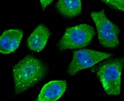 Invitrogen OGT Recombinant Rabbit Monoclonal Antibody (JB44-39) 100 &mu;L;