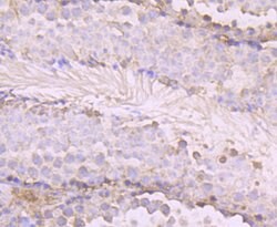 Invitrogen OGT Recombinant Rabbit Monoclonal Antibody (JB44-39) 100 &mu;L;