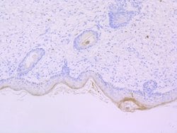Invitrogen Mast Cell Chymase Recombinant Rabbit Monoclonal Antibody (JB74-32)