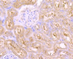 Invitrogen VPS26A Recombinant Rabbit Monoclonal Antibody (JB93-41) 100
