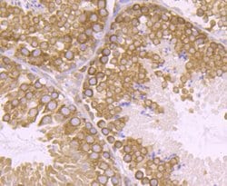 Invitrogen VPS26A Recombinant Rabbit Monoclonal Antibody (JB93-41) 100