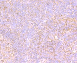 Invitrogen VPS26A Recombinant Rabbit Monoclonal Antibody (JB93-41) 100