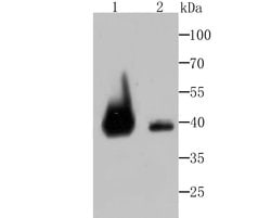 Invitrogen VPS26A Recombinant Rabbit Monoclonal Antibody (JB93-41) 100