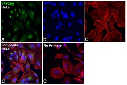 Invitrogen VPS26A Recombinant Rabbit Monoclonal Antibody (JB93-41) 100