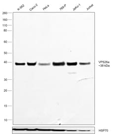 Invitrogen VPS26A Recombinant Rabbit Monoclonal Antibody (JB93-41) 100