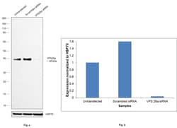 Invitrogen VPS26A Recombinant Rabbit Monoclonal Antibody (JB93-41) 100