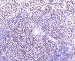 Invitrogen IKAROS Recombinant Rabbit Monoclonal Antibody (JB50-38) 100