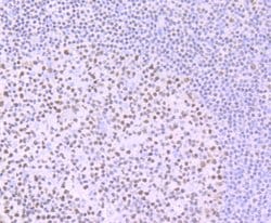 Invitrogen IKAROS Recombinant Rabbit Monoclonal Antibody (JB50-38) 100