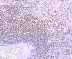 Invitrogen IKAROS Recombinant Rabbit Monoclonal Antibody (JB50-38) 100