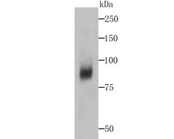 Invitrogen DCP1A Recombinant Rabbit Monoclonal Antibody (JB51-34) 100 &mu;L | Buy Online | Invitrogen&trade; | Fisher Scientific