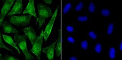 Invitrogen Phospho-alpha Synuclein (Ser129) Recombinant Rabbit Monoclonal