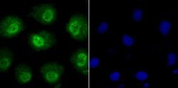 Invitrogen Phospho-alpha Synuclein (Ser129) Recombinant Rabbit Monoclonal