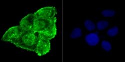 Invitrogen Phospho-alpha Synuclein (Ser129) Recombinant Rabbit Monoclonal