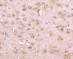 Invitrogen Phospho-alpha Synuclein (Ser129) Recombinant Rabbit Monoclonal