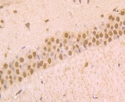 Invitrogen Phospho-alpha Synuclein (Ser129) Recombinant Rabbit Monoclonal
