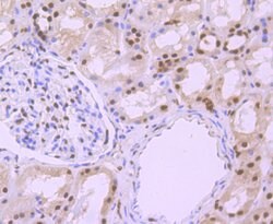 Invitrogen Phospho-alpha Synuclein (Ser129) Recombinant Rabbit Monoclonal