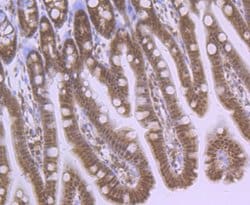 Invitrogen HIF-2 alpha Recombinant Rabbit Monoclonal Antibody (JB24-42)