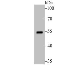 Invitrogen p53 Recombinant Rabbit Monoclonal Antibody (JB42-26) 100 &mu;L | Buy Online | Invitrogen&trade; | Fisher Scientific