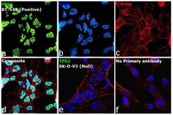 Invitrogen p53 Recombinant Rabbit Monoclonal Antibody (JB42-26) 100 &mu;L | Buy Online | Invitrogen&trade; | Fisher Scientific