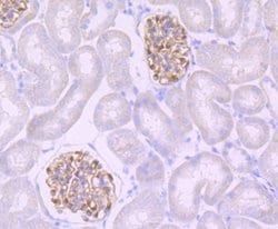 Invitrogen Podocin Recombinant Rabbit Monoclonal Antibody (JB51-33) 100