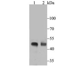 Invitrogen Podocin Recombinant Rabbit Monoclonal Antibody (JB51-33) 100