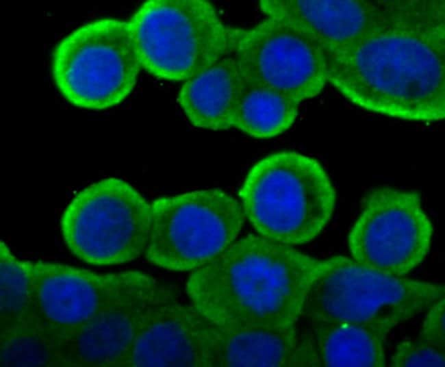 Cytochrome P450 4A (H12) Rabbit mAb main image 1