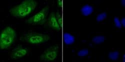 Invitrogen PSMB8 Recombinant Rabbit Monoclonal Antibody (JB54-32) 100 &mu;L;