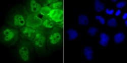 Invitrogen PSMB8 Recombinant Rabbit Monoclonal Antibody (JB54-32) 100 &mu;L;