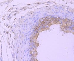 Invitrogen PSMB8 Recombinant Rabbit Monoclonal Antibody (JB54-32) 100 &mu;L;