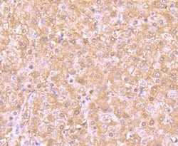 Invitrogen PSMB8 Recombinant Rabbit Monoclonal Antibody (JB54-32) 100 &mu;L;