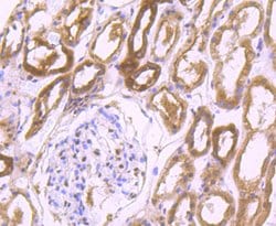 Invitrogen PSMB8 Recombinant Rabbit Monoclonal Antibody (JB54-32) 100 &mu;L;