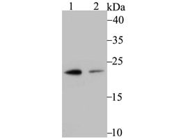Invitrogen PSMB8 Recombinant Rabbit Monoclonal Antibody (JB54-32) 100 &mu;L;