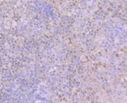 Invitrogen BCL11A Recombinant Rabbit Monoclonal Antibody (JB35-68) 100