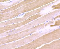 Invitrogen Calsequestrin Recombinant Rabbit Monoclonal Antibody (JB57-37)