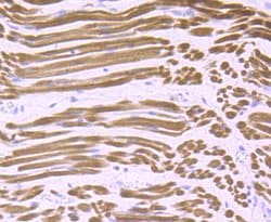 Invitrogen Calsequestrin Recombinant Rabbit Monoclonal Antibody (JB57-37)