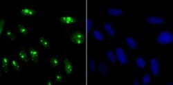 Invitrogen KDM5A Recombinant Rabbit Monoclonal Antibody (JB36-60) 100 &mu;L;