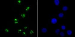 Invitrogen KDM5A Recombinant Rabbit Monoclonal Antibody (JB36-60) 100 &mu;L;