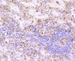 Invitrogen Gelsolin Recombinant Rabbit Monoclonal Antibody (JB36-68) 100 &mu;L | Buy Online | Invitrogen&trade; | Fisher Scientific