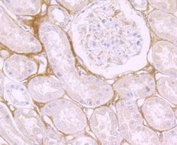Invitrogen Biglycan Recombinant Rabbit Monoclonal Antibody (JB71-31) 100